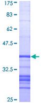 SDS-PAGE - Recombinant Human Alkaline Phosphatase, Tissue Non-Specific protein (AB114267), expandable thumbnail