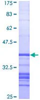 SDS-PAGE - Recombinant Human Alkaline Phosphatase, Tissue Non-Specific protein (GST tag N-Terminus) (AB114267)