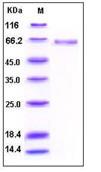 SDS-PAGE - Recombinant Human Alkaline Phosphatase, Tissue Non-Specific protein (His tag) (AB276269), expandable thumbnail