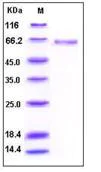 SDS-PAGE - Recombinant Human Alkaline Phosphatase, Tissue Non-Specific protein (His tag) (AB276269)