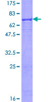 Recombinant Human ALKBH1 protein