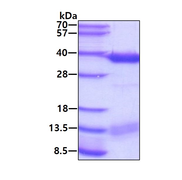 SDS-PAGE - Recombinant Human ALKBH2 protein (His tag N-Terminus) (AB105622)