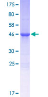 Recombinant Human ALKBH7 protein