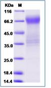 SDS-PAGE - Recombinant Human Allergin 1 protein (Fc Chimera) (AB276719), expandable thumbnail