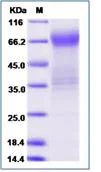 SDS-PAGE - Recombinant Human Allergin 1 protein (Fc Chimera) (AB276719)