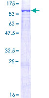 SDS-PAGE - Recombinant Human ALOX12B protein (GST tag N-Terminus) (AB157877)