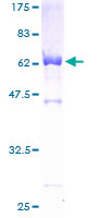 SDS-PAGE - Recombinant Human ALP protein (AB132004)