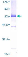 SDS-PAGE - Recombinant Human ALP protein (AB132004)