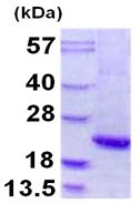 SDS-PAGE - Recombinant Human Alpha 1 Acid Glycoprotein/AGP (denatured) (AB109931), expandable thumbnail