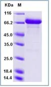 SDS-PAGE - Recombinant Human alpha 1 Fetoprotein (Fc Chimera) (AB276468)