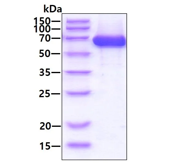 SDS-PAGE - Recombinant Human alpha 1 Fetoprotein (AB207113)