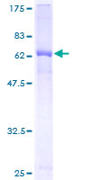 Recombinant Human Alpha 1 microglobulin protein