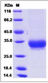 SDS-PAGE - Recombinant Human Alpha 1 microglobulin protein (His tag) (AB276501)
