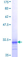 SDS-PAGE - Recombinant Human alpha 1d Adrenergic Receptor protein (AB157861), expandable thumbnail