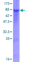 Recombinant Human Alpha 2 Antiplasmin protein