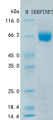SDS-PAGE - Recombinant Human alpha-2 antiplasmin Protein Standard (His tag) (AB316422)