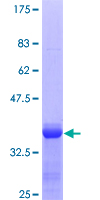 Recombinant Human alpha 2 Macroglobulin protein