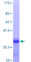 SDS-PAGE - Recombinant Human alpha 2 Macroglobulin protein (GST tag N-Terminus) (AB157817)