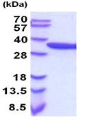SDS-PAGE - Recombinant Human alpha Actinin/ACTN1 protein (AB207132)