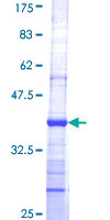 SDS-PAGE - Recombinant Human alpha COP I/COPA protein (AB152291)