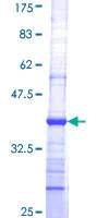SDS-PAGE - Recombinant Human alpha COP I/COPA protein (GST tag N-Terminus) (AB152291)