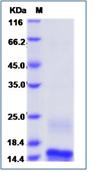 SDS-PAGE - Recombinant Human alpha Lactalbumin protein (His tag) (AB276670)
