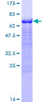 SDS-PAGE - Recombinant Human alpha Sarcoglycan protein (AB132339)
