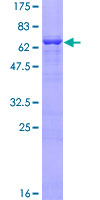 SDS-PAGE - Recombinant Human Alpha Skeletal Muscle Actin protein (AB157838), expandable thumbnail