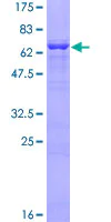 SDS-PAGE - Recombinant Human Alpha Skeletal Muscle Actin protein (AB157838)