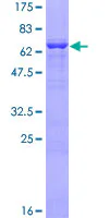 SDS-PAGE - Recombinant Human Alpha Skeletal Muscle Actin protein (GST tag N-Terminus) (AB157838)