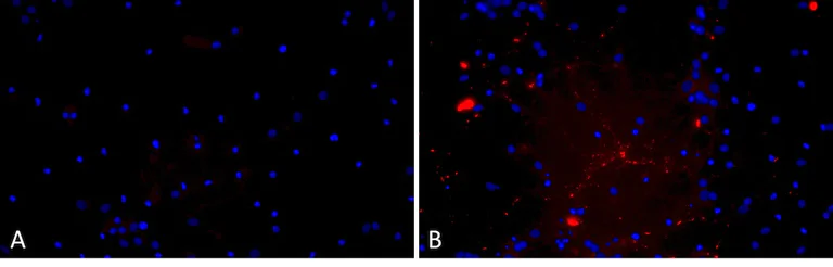 Immunohistochemistry (Formalin/PFA-fixed paraffin-embedded sections) - Recombinant Human Alpha-synuclein (mutated A53T) protein aggregate Type 1 (Active) (AB256150)