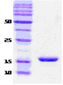 SDS-PAGE - Recombinant Human Alpha-synuclein (mutated E46K) protein (Tag Free) (AB51188)
