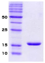 SDS-PAGE - Recombinant Human Alpha-synuclein protein (AB51189)