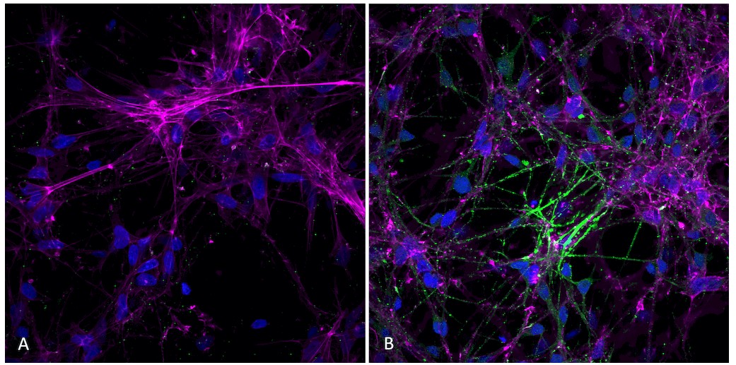 Immunocytochemistry/ Immunofluorescence - Recombinant Human Alpha-synuclein protein aggregate (Active) (ab218819), expandable thumbnail