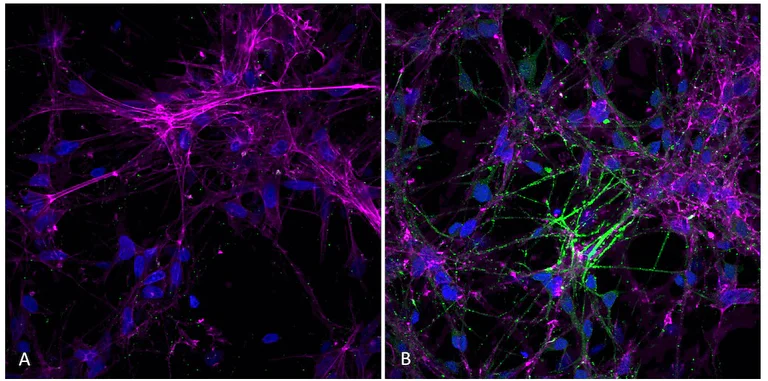 Immunocytochemistry/ Immunofluorescence - Recombinant Human Alpha-synuclein protein aggregate (Active) (AB218819)