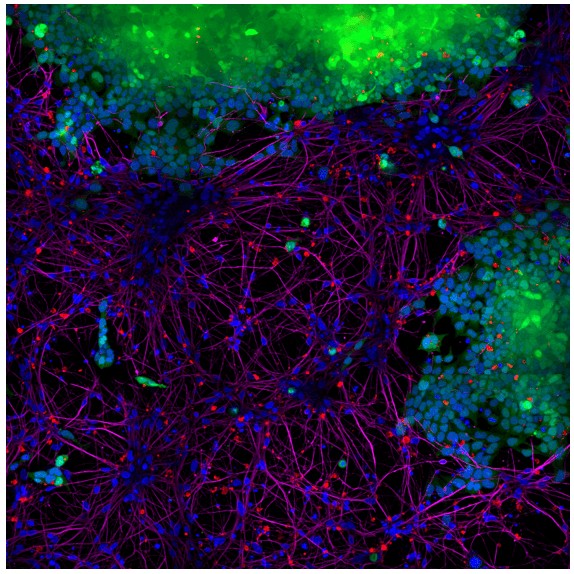 Immunocytochemistry/ Immunofluorescence - Recombinant Human Alpha-synuclein protein aggregate (Active) (ab218819), expandable thumbnail