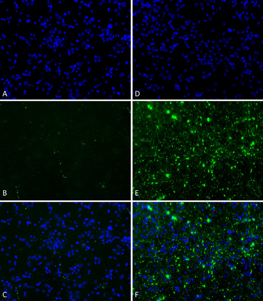 Immunohistochemistry (Formalin/PFA-fixed paraffin-embedded sections) - Recombinant Human Alpha-synuclein protein aggregate (Active) (AB218819), expandable thumbnail