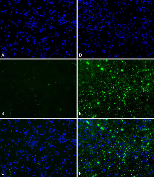 Immunohistochemistry (Formalin/PFA-fixed paraffin-embedded sections) - Recombinant Human Alpha-synuclein protein aggregate (Active) (AB218819)