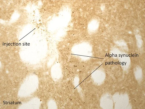Immunohistochemistry (Formalin/PFA-fixed paraffin-embedded sections) - Recombinant Human Alpha-synuclein protein aggregate (Active) (AB218819)