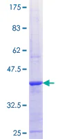 SDS-PAGE - Recombinant Human ALPK1 protein (AB164225)