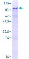 SDS-PAGE - Recombinant Human AMBN protein (AB116972)