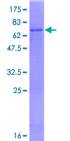 SDS-PAGE - Recombinant Human AMCase protein (GST tag N-Terminus) (AB132796)