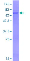 SDS-PAGE - Recombinant Human AMCase protein (AB132796)