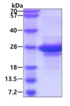 SDS-PAGE - Recombinant Human Amelotin protein (His tag N-Terminus) (AB137137)
