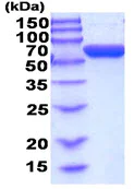 SDS-PAGE - Recombinant human AMF protein (Bioactivity Validated) (His tag N-Terminus) (AB208311)