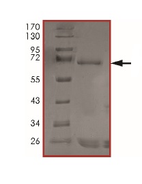 SDS-PAGE - Recombinant Human AMHR2 protein (AB201383)