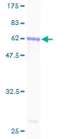 SDS-PAGE - Recombinant Human AMID protein (AB164678)