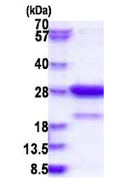 SDS-PAGE - Recombinant Human Amisyn protein (His tag N-Terminus) (AB183235)