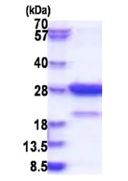 SDS-PAGE - Recombinant Human Amisyn protein (His tag N-Terminus) (AB183235)
