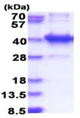 SDS-PAGE - Recombinant Human AMMECR1L protein (AB183169)